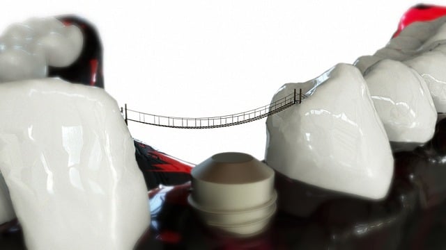 Transform Your Smile, Save Big: Walk-in Denture Repair Leamington