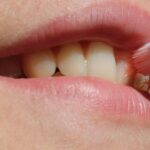 dental-cleaning-640x480-34416677.jpeg