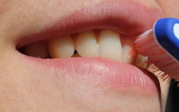 dental-cleaning-640x480-34416677.jpeg