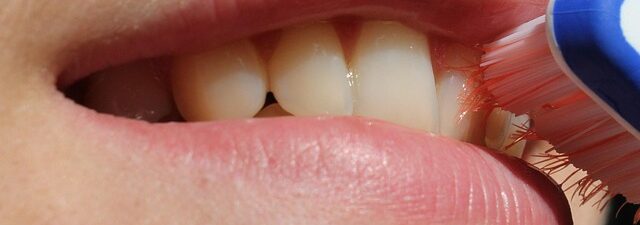 dental-cleaning-640x480-34416677.jpeg