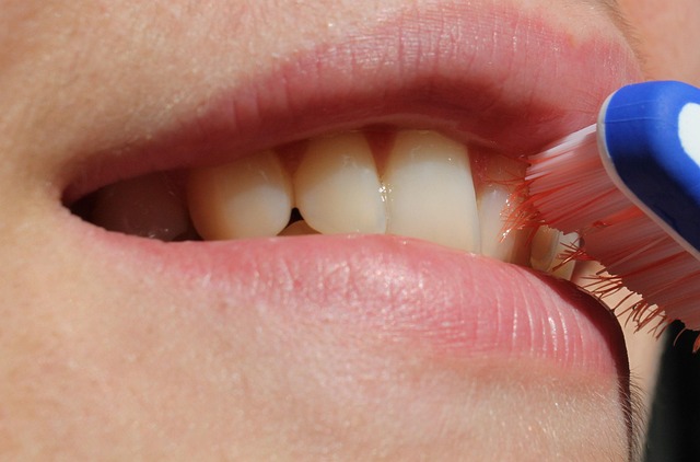 dental-cleaning-640x480-34416677.jpeg
