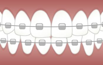 dental-crowns-640x480-38830081.jpeg