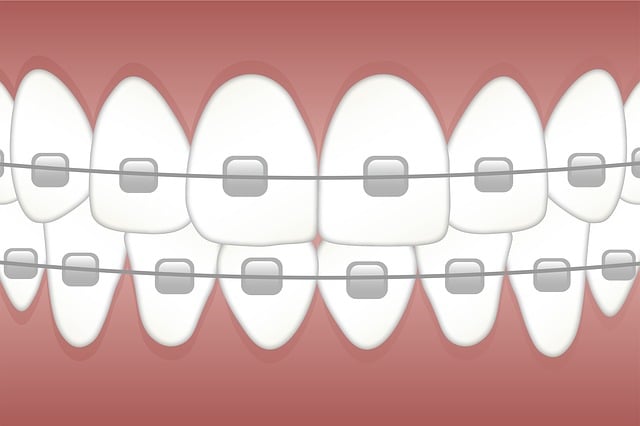 Transform Your Grin, Save Big: Free Consultation for Safe Teeth Whitening in Milton