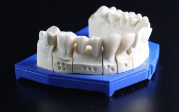 dental-crowns-640x480-62392561.jpeg