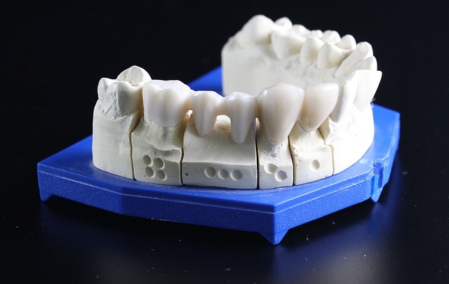 Transform Your Grin: Expert Dental Crowns for a Confident, Affordable You in Milton Ontario