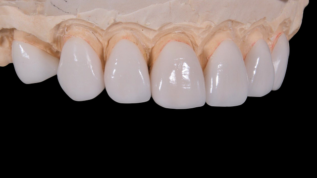 Experience Calmer Smiles at Clearview Dental Milton’s Art-Inspired Revolution