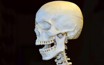 free-denture-consultation-leamington-640x480-30137933.jpeg
