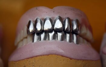 free-denture-consultation-leamington-640x480-425978.jpeg