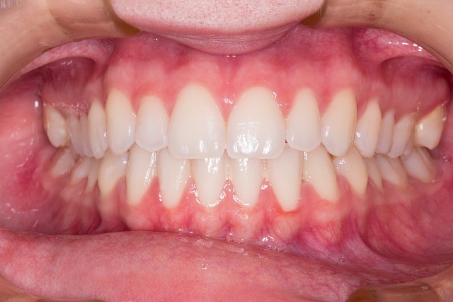 teeth-whitening-640x480-24570301.jpeg