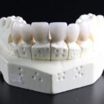 teeth-whitening-640x480-40096967.jpeg