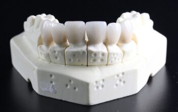 teeth-whitening-640x480-40096967.jpeg