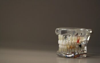 teeth-whitening-640x480-43276956.jpeg