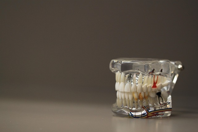 teeth-whitening-640x480-43276956.jpeg