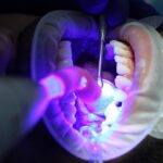 dental-cleaning-640x480-10639583.jpeg