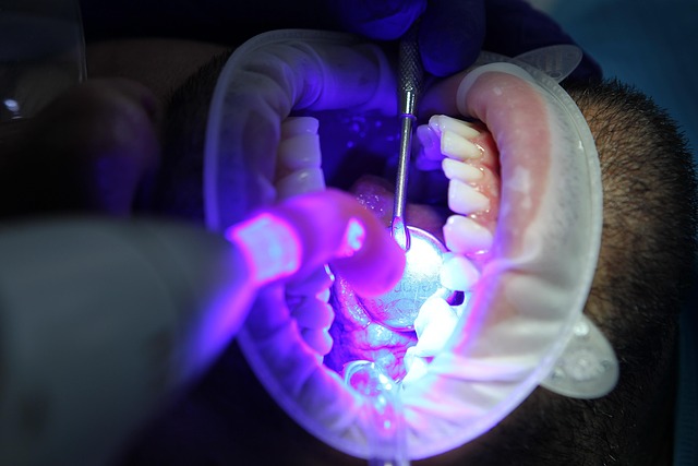 dental-cleaning-640x480-10639583.jpeg