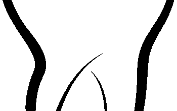 dental-cleaning-640x480-85422383.png