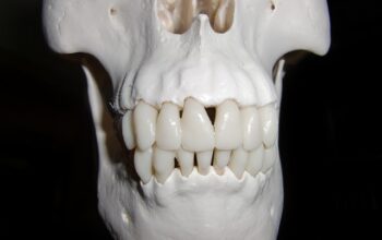 free-denture-consultation-leamington-640x480-16822987.jpeg