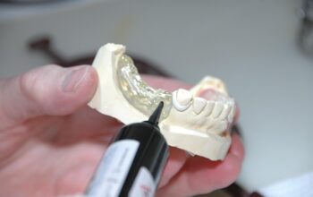 implant-dentures-640x480-66269445.jpeg