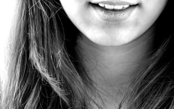 teeth-whitening-640x480-11774954.jpeg