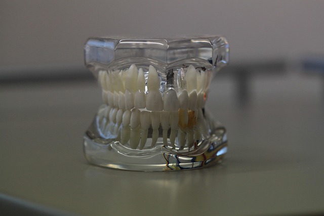 Transform Your Smile, Save Now: Best Denture Fitting in Leamington!