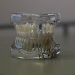 implant-dentures-640x480-64584724.jpeg