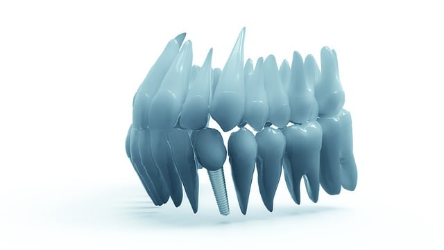 Transform Your Smile, Save Big: Partial Denture Repair Leamington