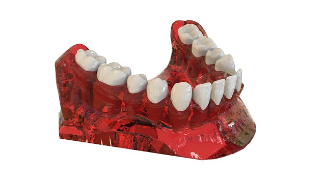 Shreve Denture Clinic: Save Money, Get a Fresh Smile – Free Reline Consultation Today!