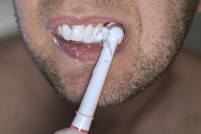 Milton Ontario’s Top Crowns: Transform Your Smile, Save Big – Free Consult!