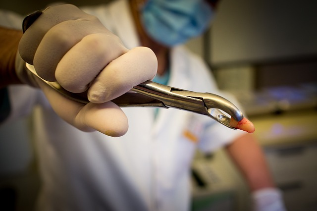 Transform Your Smile: Free Consultation & Save with Top Teeth Cleaning in Milton