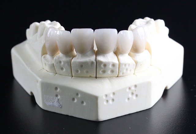 Transform Your Smile in Milton: Top-Rated Dental Crowns at Affordable Prices!