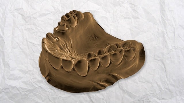 Transform Your Smile, Save with Advanced Implant Dentures in Leamington – Free Consultation Now!